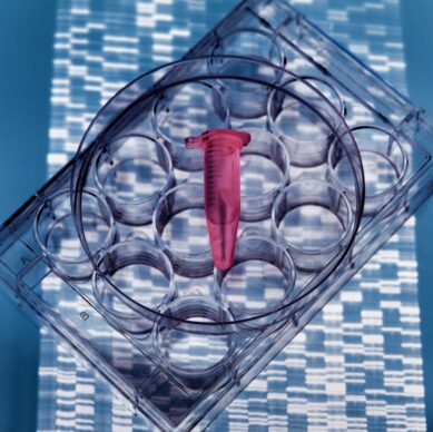 DNA sample inside vial on multi well plate, DNA gel showing results